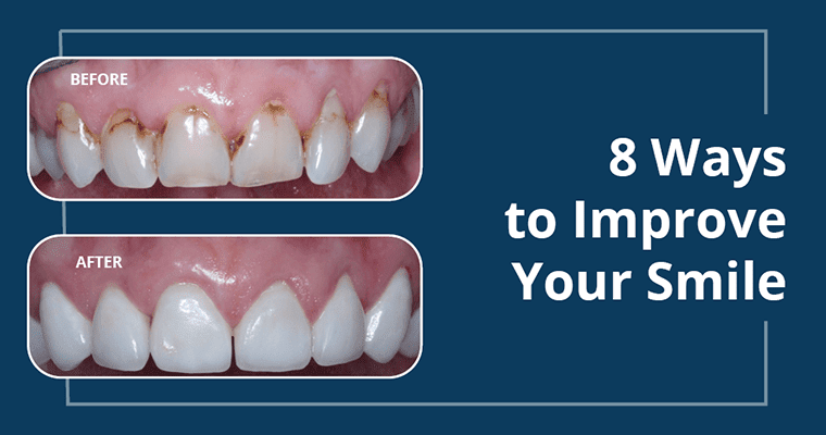 Teeth whitening before and after results